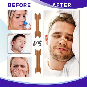 20pcs/60pcs, Breathe Easy with Multifunctional Nose Expander - Reduce Nasal Congestion and Improve Breathing