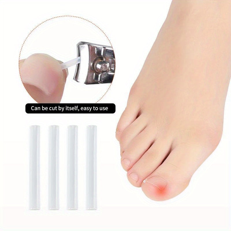 50Pcs Ingrown Toenail Correction Tool, Ingrown Toe NailElastic Patch Sticker, Straightening Clip Brace Pedicure Tool