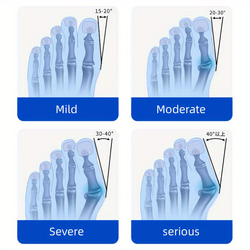 1pc Adjustable Hallux Valgus Corrector with Thickened Silicone Pad for Male and Female Toe Alignment