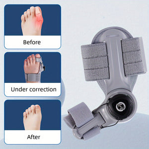 1pc Adjustable Hallux Valgus Corrector with Thickened Silicone Pad for Male and Female Toe Alignment